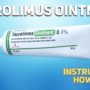 Tacrolimus ointment